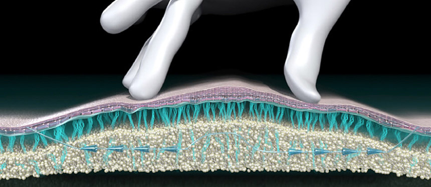 fils-tenseurs-résorbables-silhouette-soft-Lille