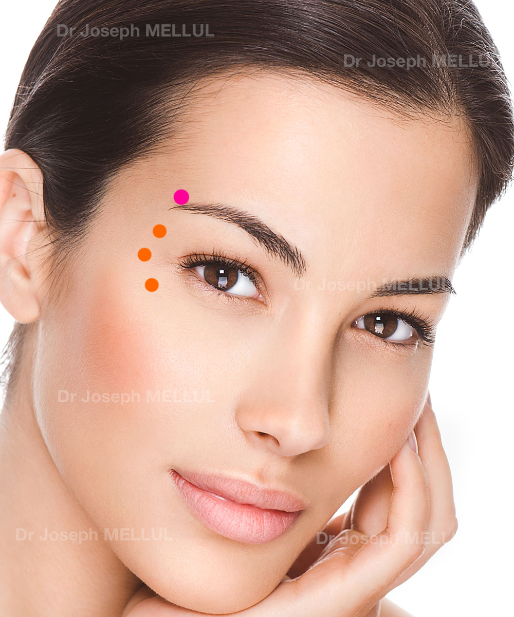 Joe Botox Botox | Docteur Joseph Mellul